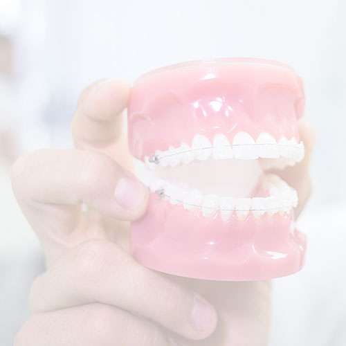 orthosquare complete denture