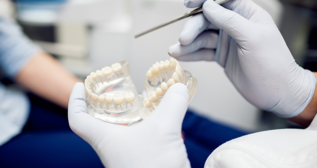 Orthosquare Dental Bonding