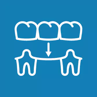 orthosquare Bridges